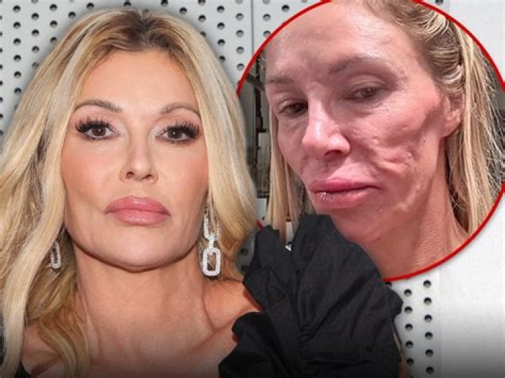 Brandi Glanville Reveals Hospitalization for Unknown Problem