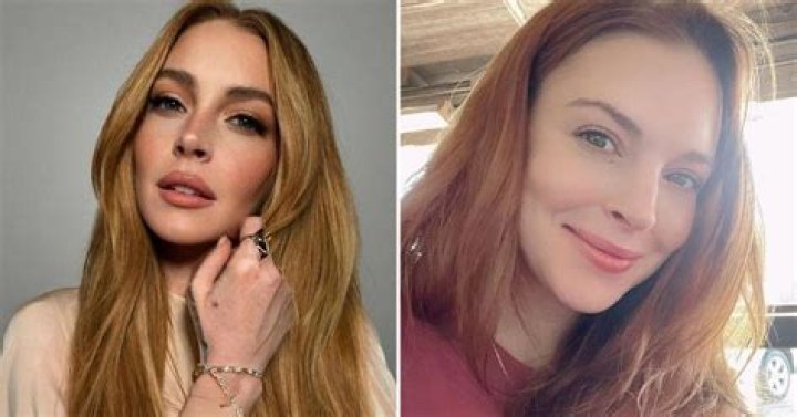 Did Lindsay get Botox?