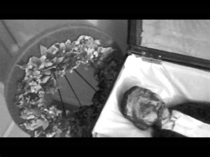 Emmett Till injuries autopsy