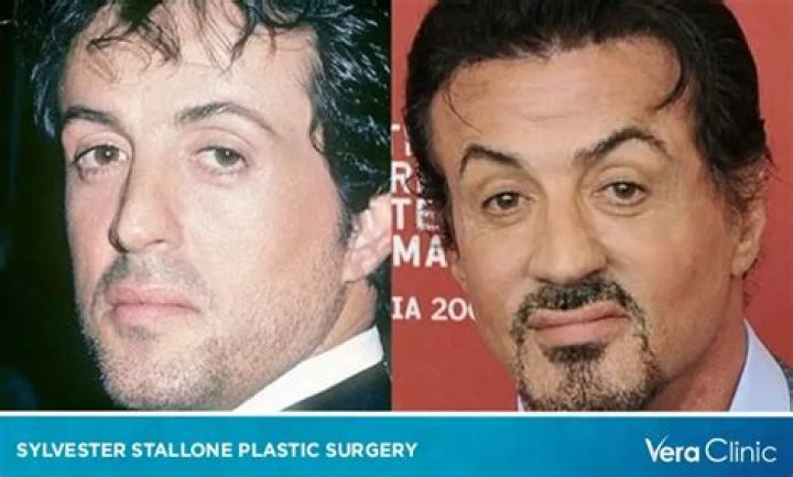 Is Sylvester Stallone’s face melting?