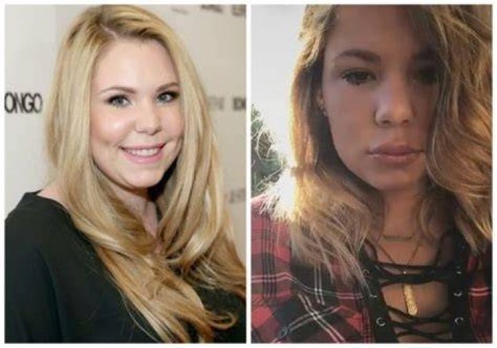 kailyn lowry lips