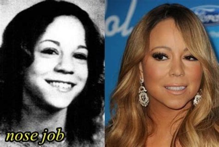 Mariah Carey Nose Job