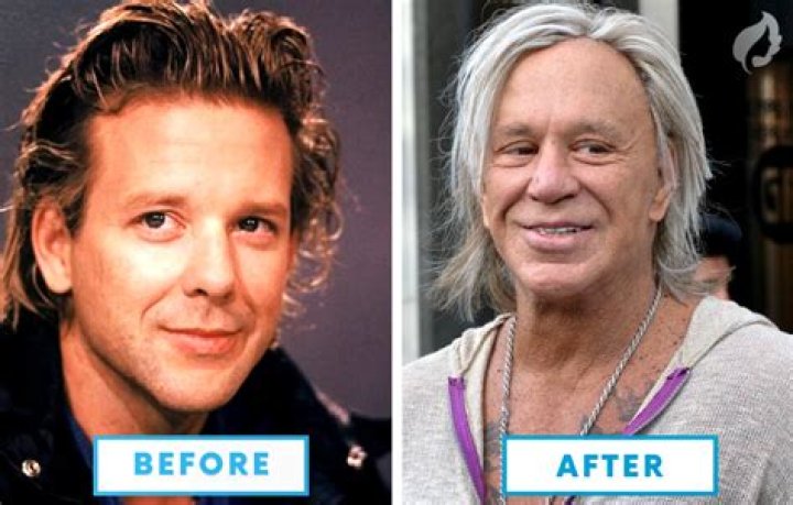 mickey rourke botched featured image