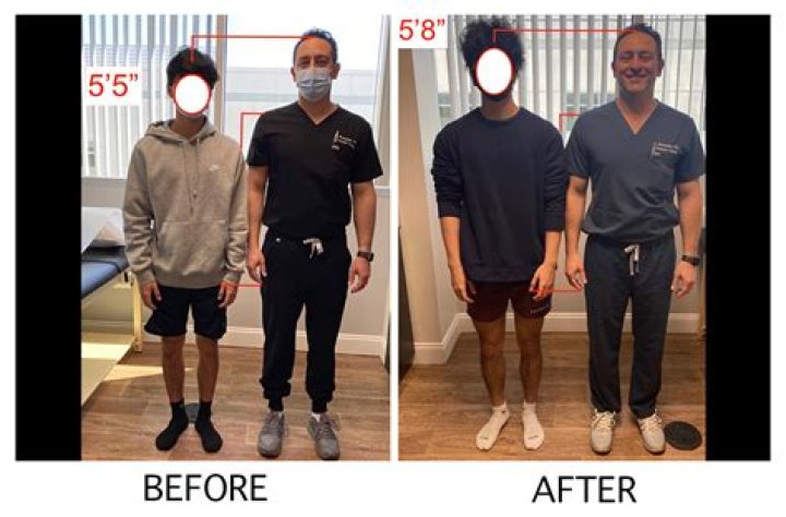 Plastic Surgery, Height & Photos