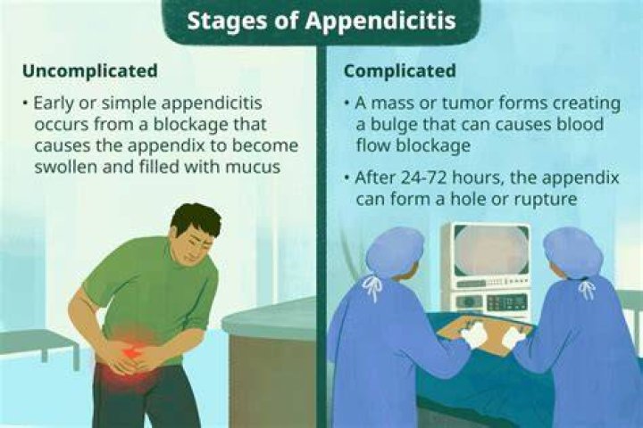 Stephen Colbert Appendicitis