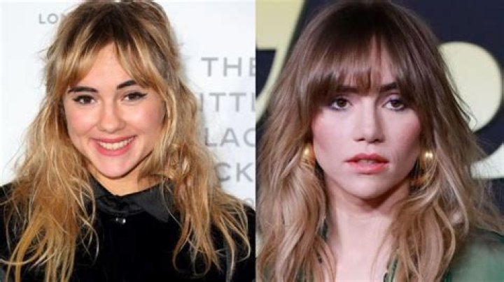 Suki Waterhouse Plastic Surgery