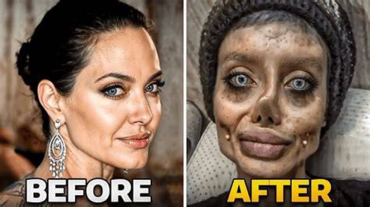 This Actor is Unrecognizable After His Plastic Surgery