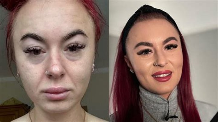 Transgender Singer Haifa Magic’s Before And After Surgery