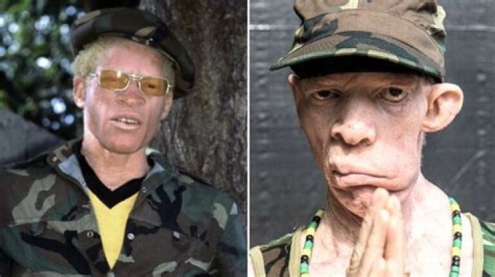 What Happened to Yellowman face